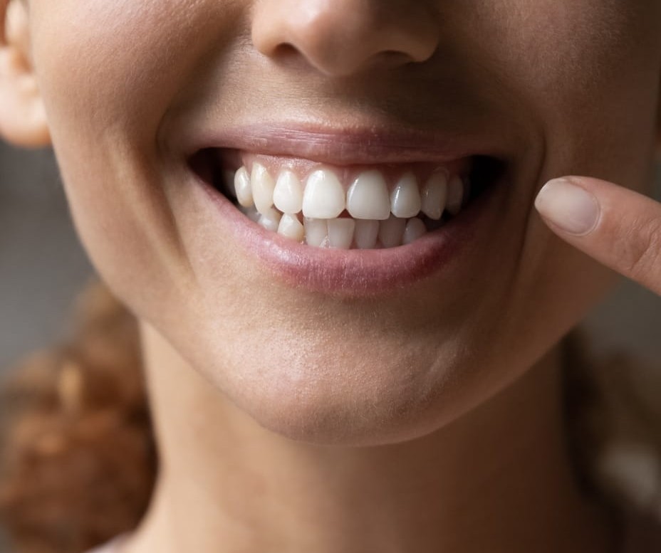 cosmetic dentist assessing smile design in Dubai